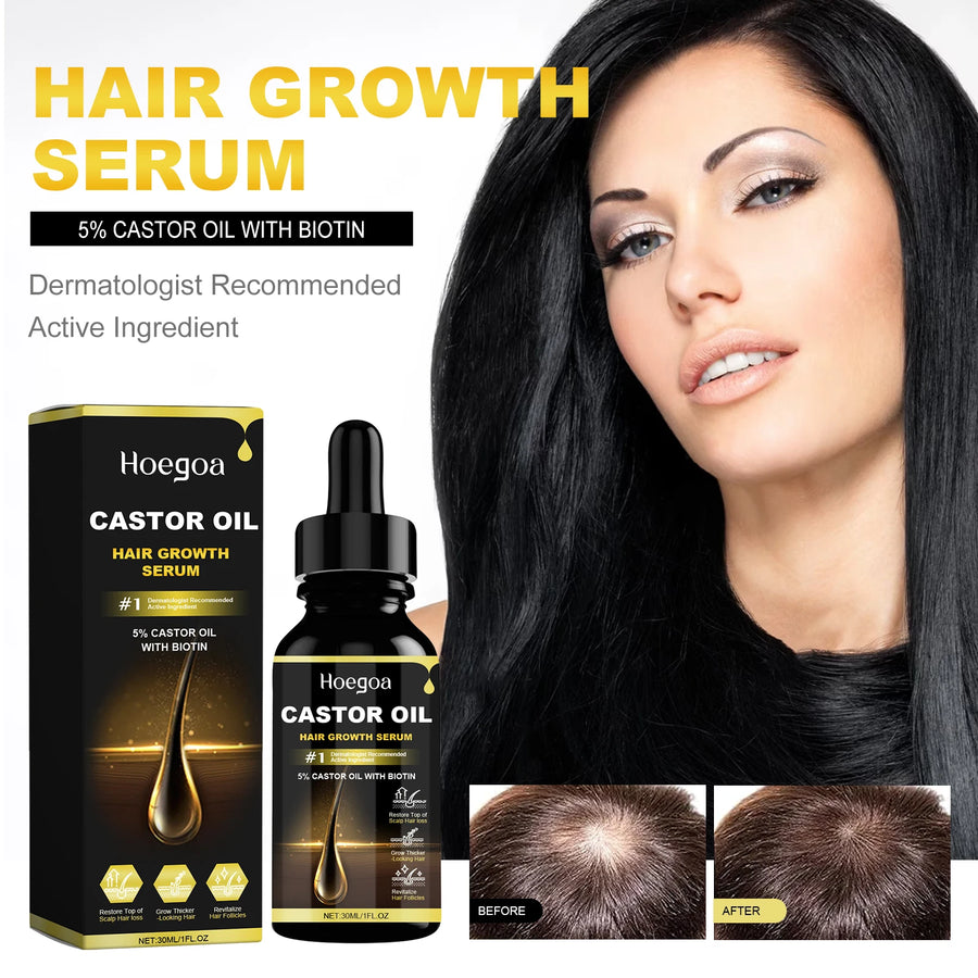 Hoegoa Castor Oil Hair Thickening Care Oil (30ml)