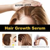 Hoegoa Castor Oil Hair Thickening Care Oil (30ml)