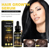 Hoegoa Castor Oil Hair Thickening Care Oil (30ml)