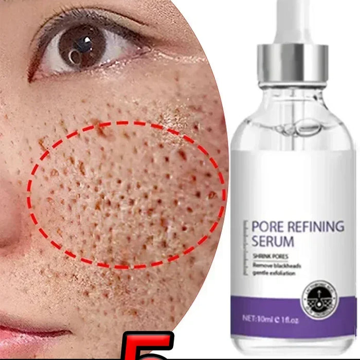 Skin Texture & Pore Refining Resurfacing Serum