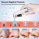 Electric Blackhead Remover & Pore Vacuum Cleaner