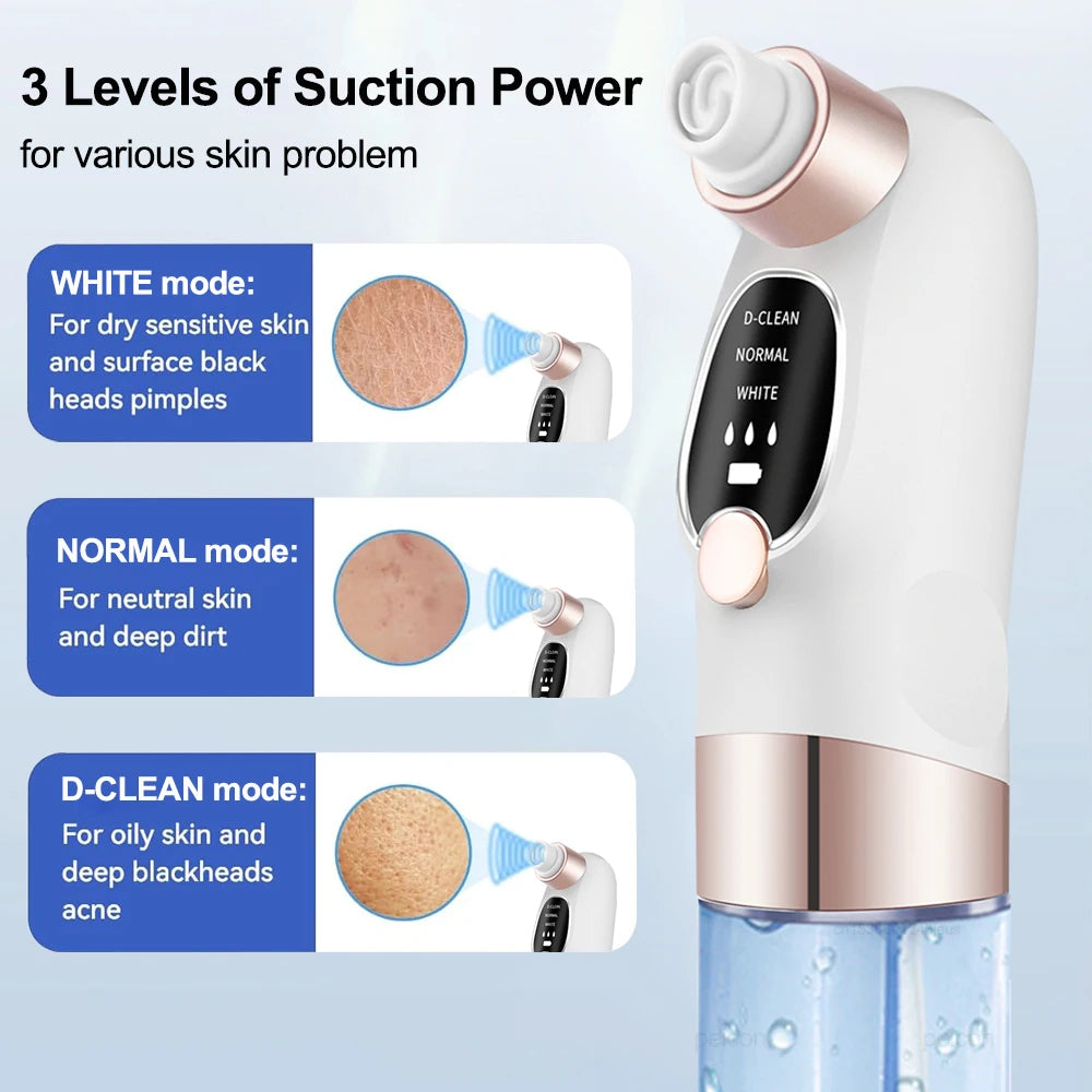 Electric Blackhead Remover & Pore Vacuum Cleaner