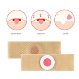 Foot Care Detox & Callus Removal Patches (6 PCS)