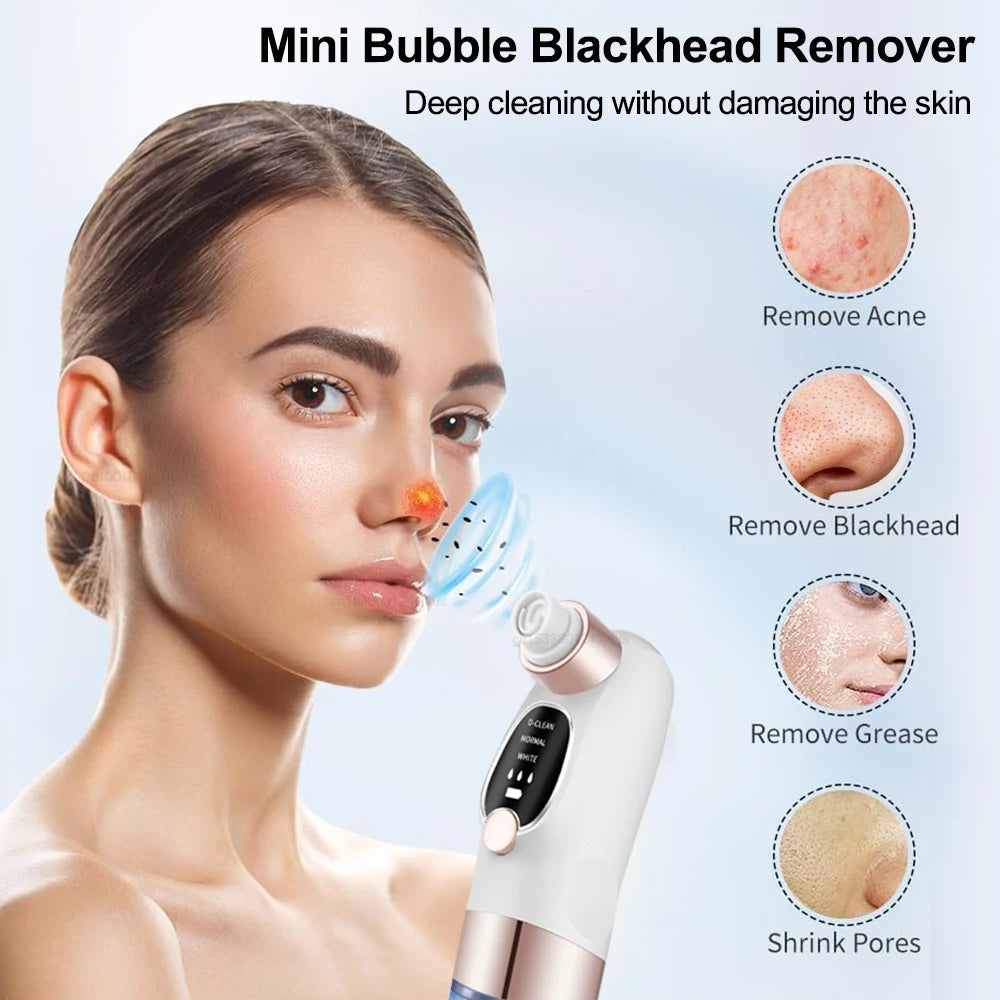 Electric Blackhead Remover & Pore Vacuum Cleaner