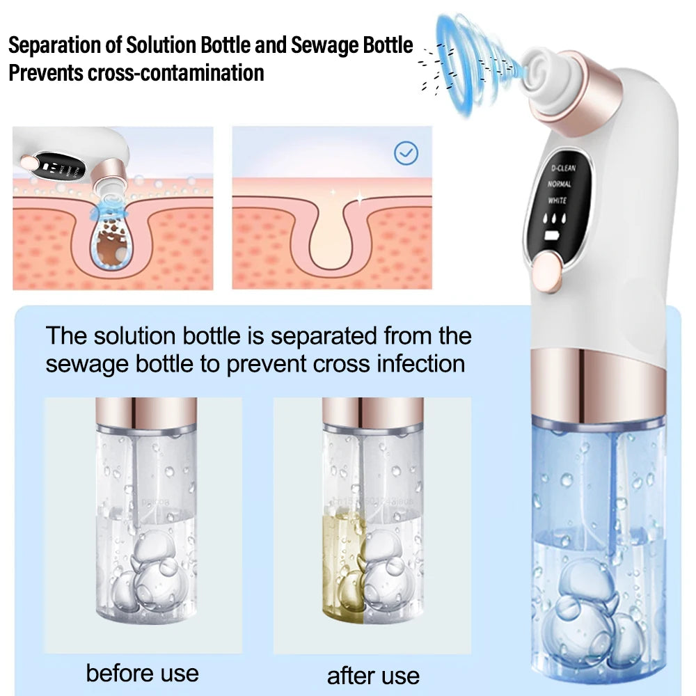 Electric Blackhead Remover & Pore Vacuum Cleaner